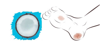Aceite de coco para las durezas de los pies