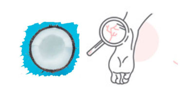 Aceite de coco para pies con hongos